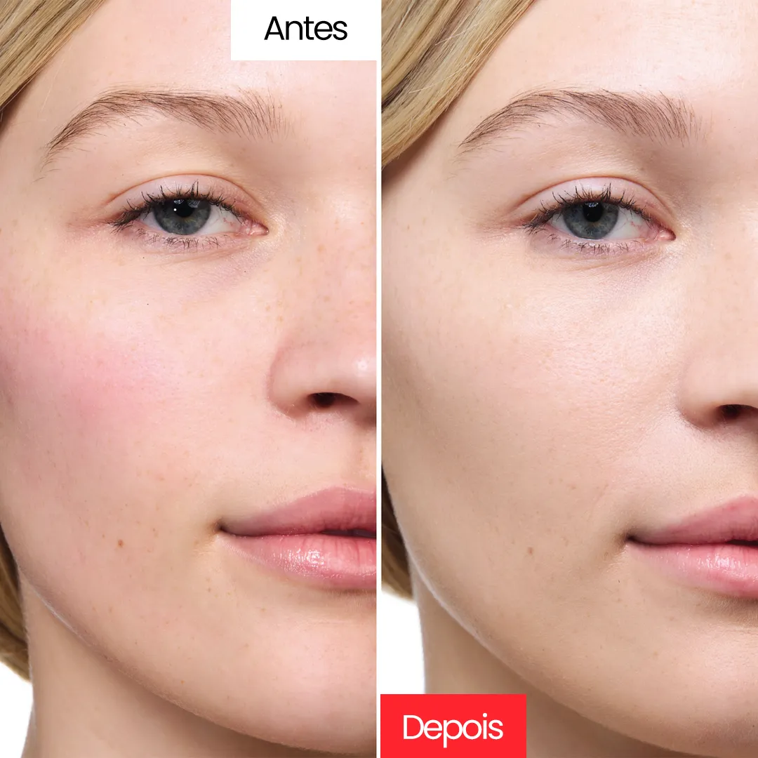 Creme Corretivo - Centella Cream™ - Image 10