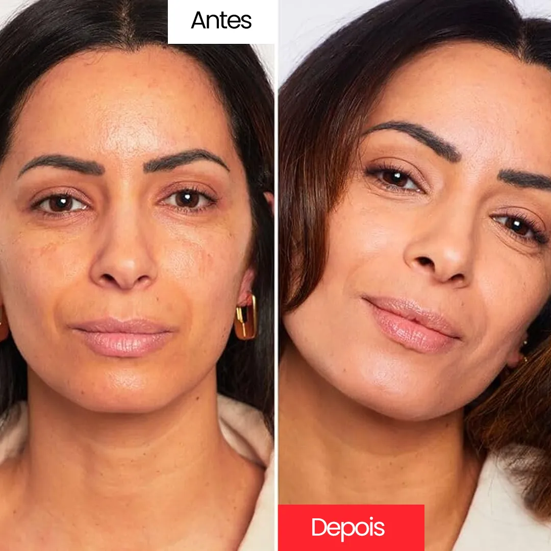 Creme Corretivo - Centella Cream™ - Image 7