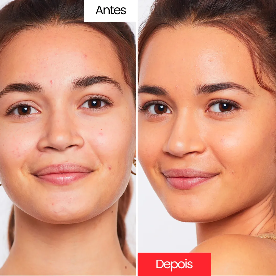 Creme Corretivo - Centella Cream™ - Image 8