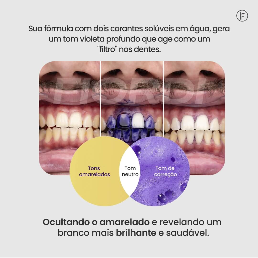 Sérum V34™ - Clareador Dentário + Brinde - Image 4